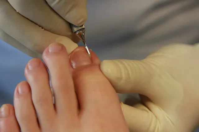 toenails-6157933_640